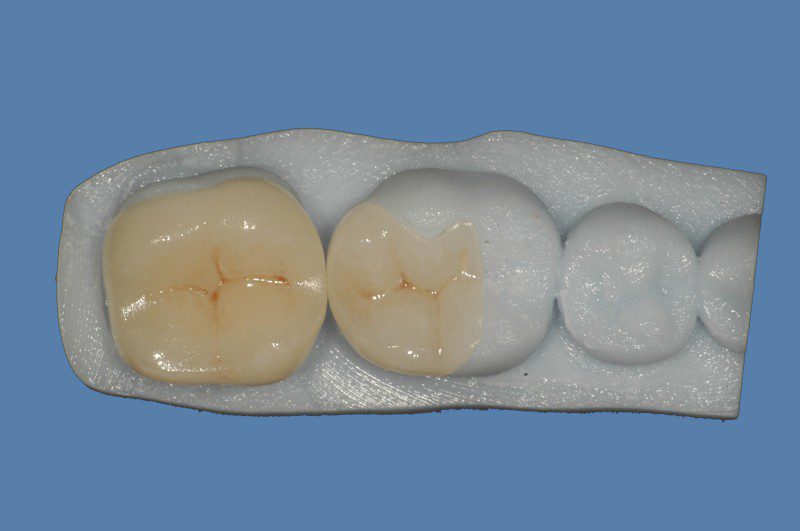 Intarsi ceramici realizzati con tecnologia digitale