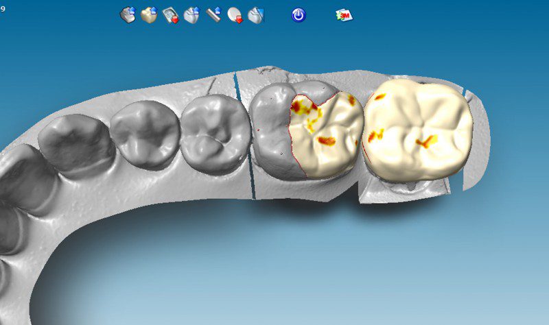 Intarsi in ceramica